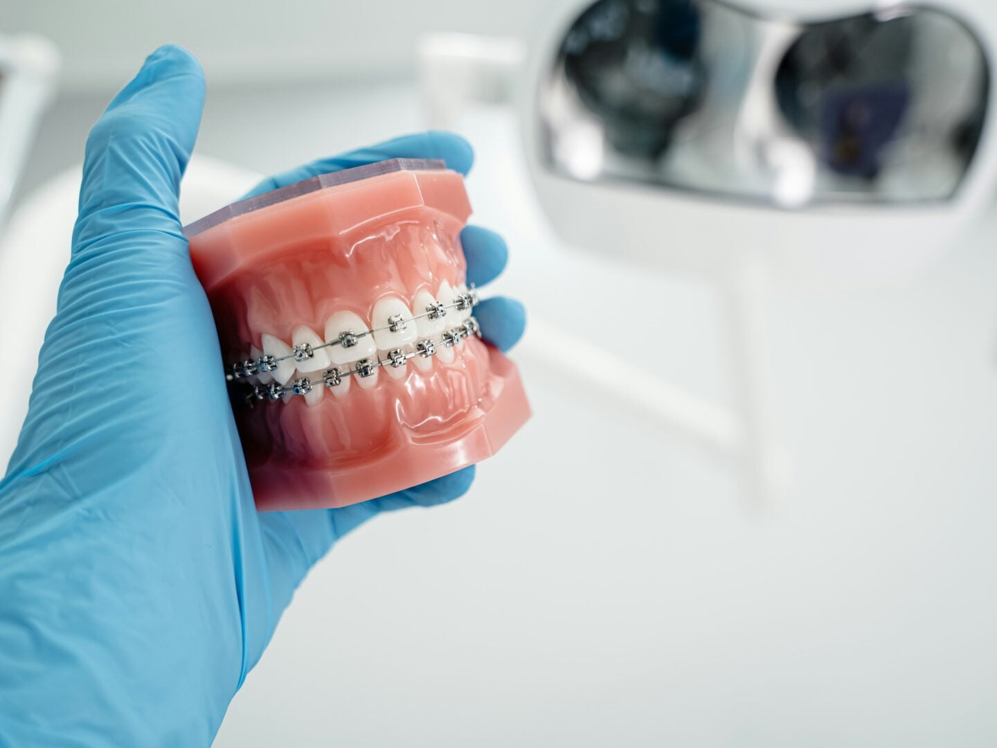 Dental professional wearing a blue glove holding a plastic model of teeth fitted with metal braces in a modern clinic.